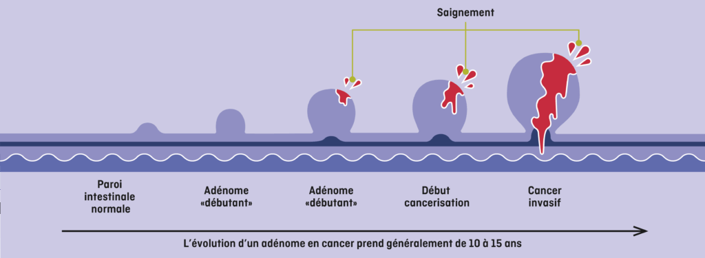 2025_0316_Images_Polypes_horizontal