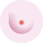 Symptome_Sein_Inflammation_du_mamelon